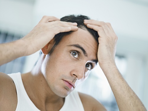 Przeszczep Włosów, Skuteczny Sposób Na łysienie